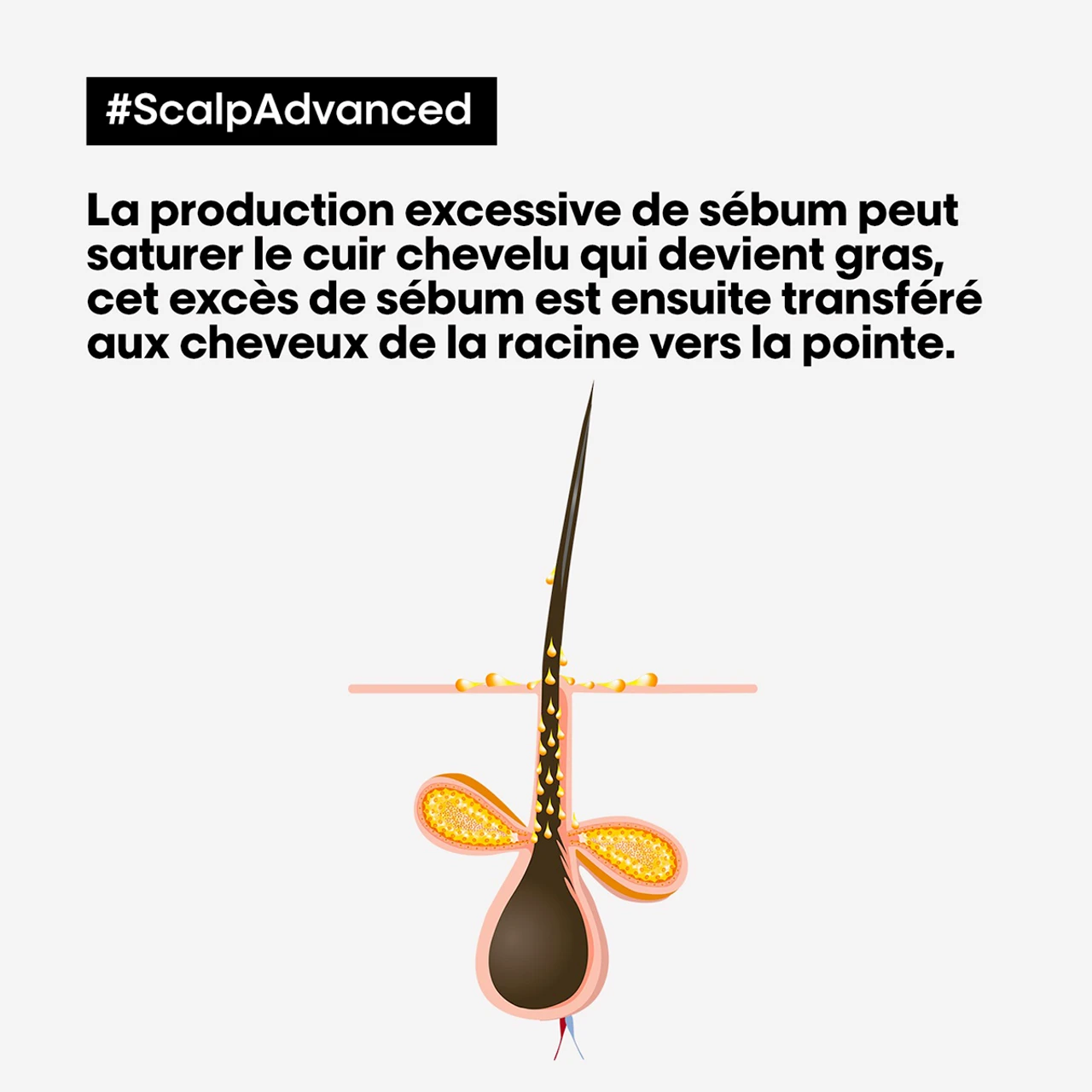 Shampooing Dermo-Purifiant Anti Gras Scalp Advanced L'Oréal 500ml 3 Shampooing Dermo-Purifiant Anti Gras Scalp Advanced L'Oréal 500ml – Image 3